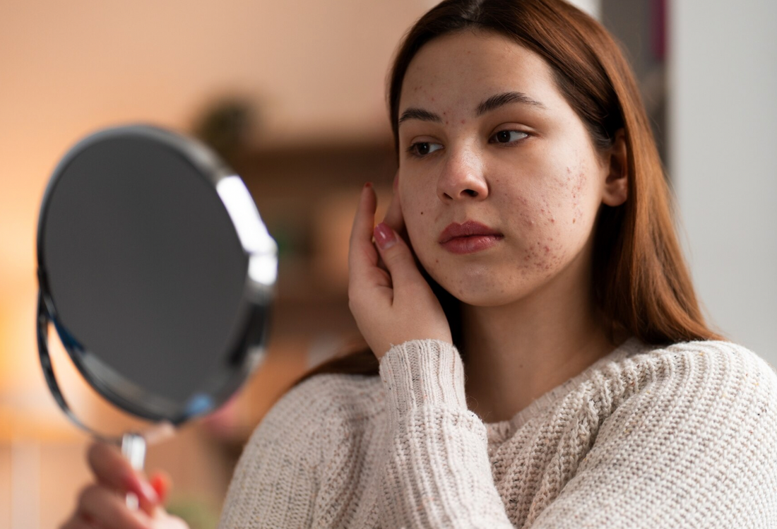 How Glutathione Helps Reduce Skin Pigmentation What's Up Wellness How Glutathione Helps Reduce Skin Pigmentation What's Up Wellness