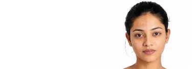 Get Acne-Free Skin