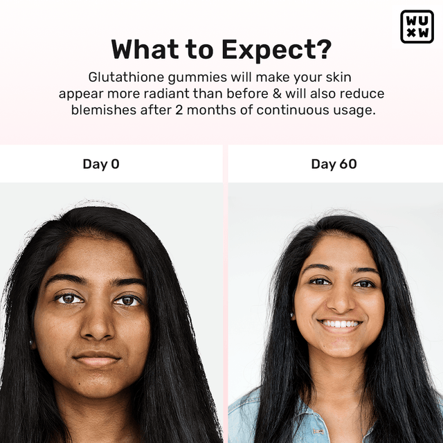 Gluta-Glow Gummies - Glutathione Supplements for Skin Glow What's Up Wellness Gluta-Glow Gummies - Glutathione Supplements for Skin Glow What's Up Wellness
